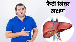 World Liver Day 2024: गर्दन के आसपास कालापन कहीं फैटी लिवर का संकेत तो नहीं? इन लक्षणों को न करें अंदाज, जानें डाइट