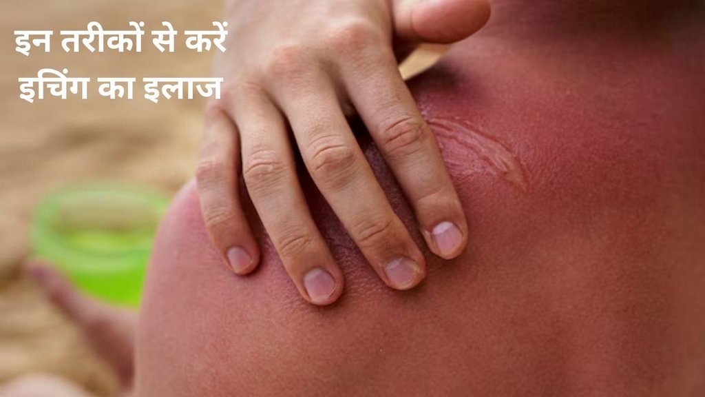 गर्मी में खुजा-खुजाकर परेशान हो रहे हैं तो एलोवेरा जेल से मसाज करें स्किन को आराम मिलेगा। freepik