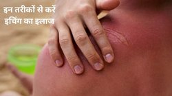 गर्मी में कमर पर घमौरियों से खुजाते-खुजाते हो गया है बुरा हाल, 4 धांसू तरीकों से खुजली का मिट जाएगा नामोनिशान, जानें कैसे