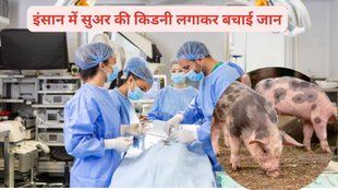 kidney transplant, women given kidney transplant, women pig kidney and heart device, surgeon transplant pig kidney, first woman to receive a pig kidney transplant, first-of-its-kind operation
