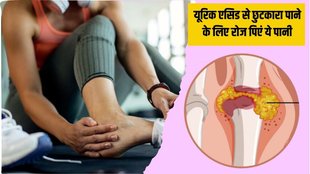 Uric Acid । Uric Acid Home Remedies । Ayurvedic Medicine for Uric acid