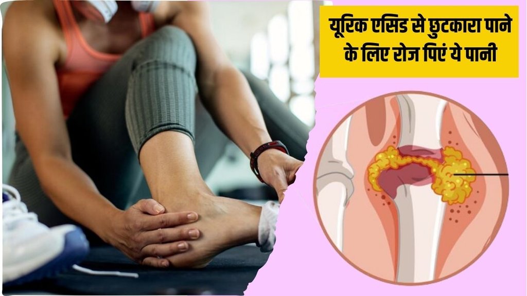 Uric Acid । Uric Acid Home Remedies । Ayurvedic Medicine for Uric acid