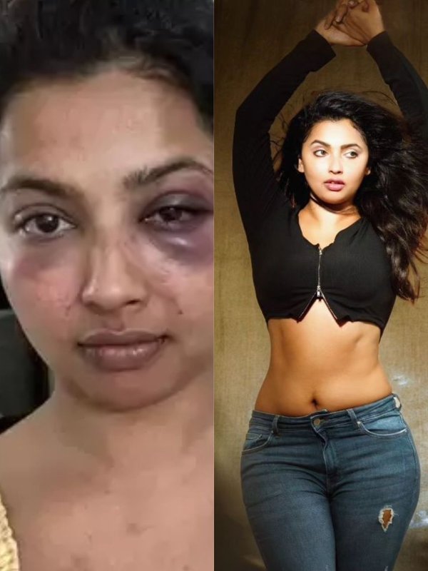 South Actress, South Actress Anicka vijayii vikraman, Anicka vijayii vikraman pics