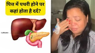 Bharti Singh । Gallstones । gallbladder stone