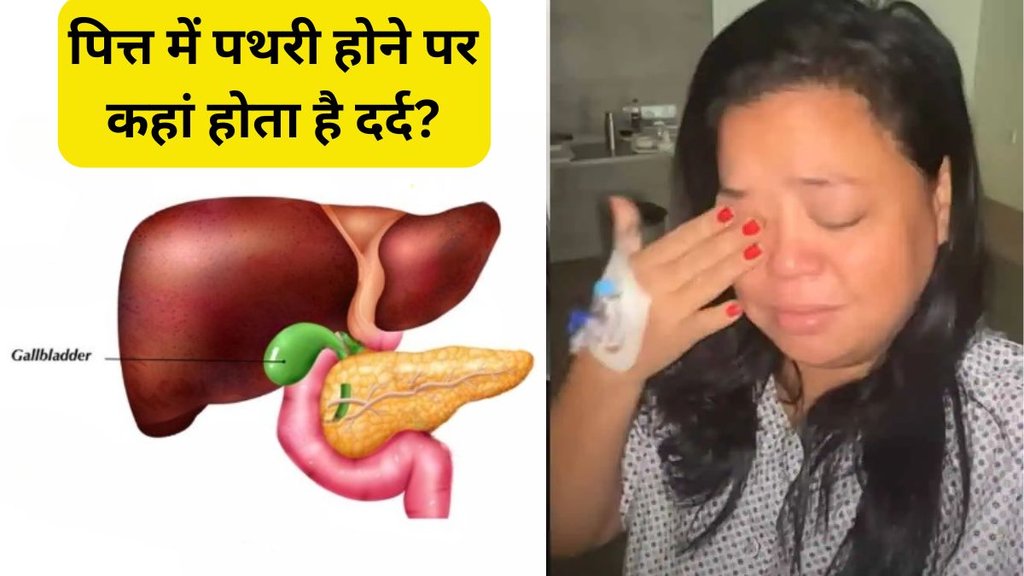 Bharti Singh । Gallstones । gallbladder stone