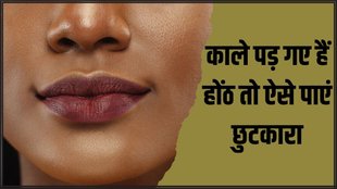 Dark Lips Remedy । Beauty Tips । Beauty Hacks