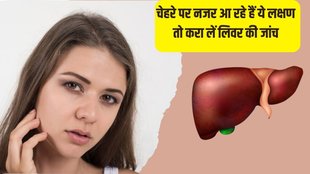 Fatty Liver । Fatty Liver Symptoms on Face । Health News