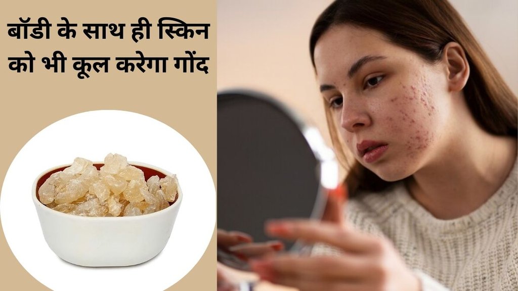 medicinal value of gond katira,amazing benefits of gond katira, gond katira for skin, gond katira for pimples, acne treatment, natural remedy, curd, mint, black salt, skincare routine, skincare pimples,
