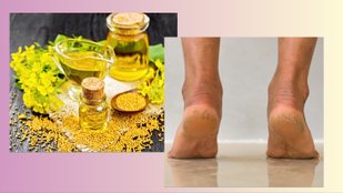 mustard oil for cracked heels