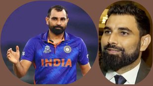 Mohammed Shami hair transplant
