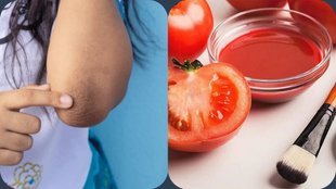 tomato for tan removal home remedies