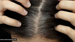 how to turn grey hair into black in 2 months