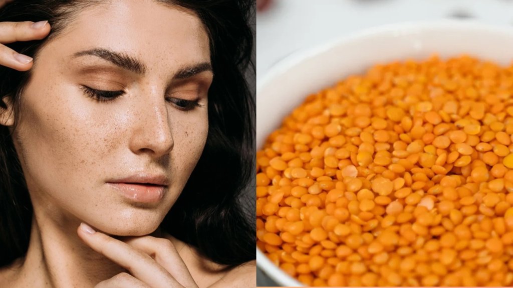 masoor dal for pigmentation