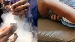 12 साल की बच्ची ने खाया Smoke Paan पेट में हुआ छेद तो करना पड़ा ऑपरेशन, जानिए कितना हो सकता है खतरनाक