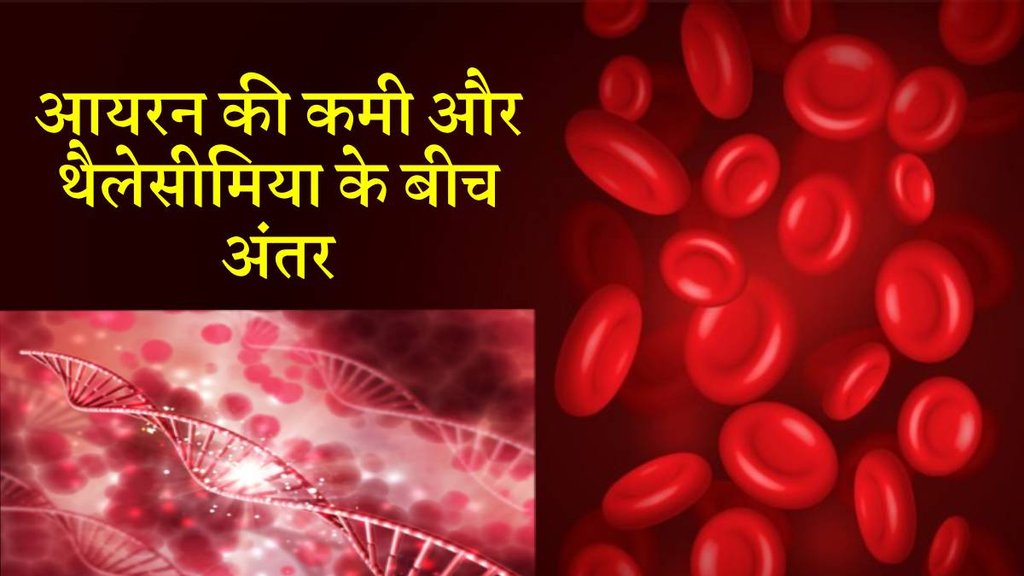 Thalassemia, Iron deficiency, anaemia, Thalassemia Trait, Thalassemia Symptoms, Test For Thalassemia,