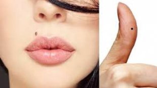 lucky mole on body, sharir par kaha til hona shubh hai