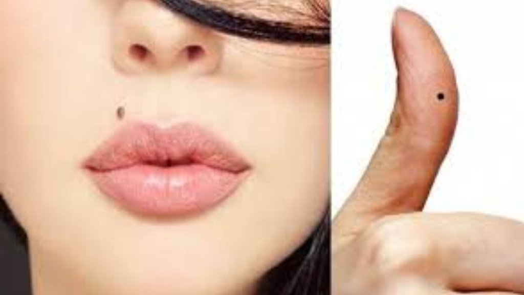 lucky mole on body, sharir par kaha til hona shubh hai