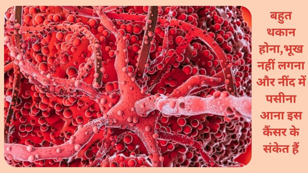 Chronic myelogenous leukemia , CML symptoms , cml prevention , cml treatment , cancer symptoms , cml in 30 to 40 , cml cause , cancer cause , cml type of cancer,CML कैंसर कब होता,