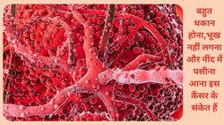 30-40 साल के युवाओं को तेजी से अपनी चपेट में ले रहा है क्रॉनिक मायलॉइड ल्यूकेमिया, गुड कैंसर के नाम से मशहूर इस Cancer से क्या बचाव है संभव, एक्सपर्ट से जानिए