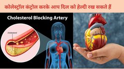नसों को जाम करने लगी है खून की गंदी चर्बी, Cholestrol का पारा भी 200 mgdl को कर गया है पार, इन 5 पीले फलों से दूर करें दिल की टेंशन