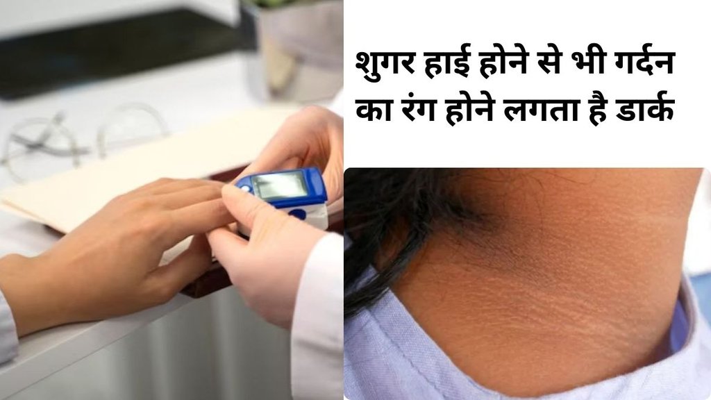 आपकी गर्दन, बगल, कमर या अन्य जगहों पर मखमली स्किन का एक डार्क पेच होने का मतलब है कि आपके ब्लड में शुगर का स्तर हाई है। freepik