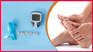 Diabetic Foot Ulcer । Diabetes । Diabetes Tips
