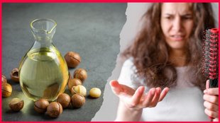 Castor Oil । Hair Loss । Hair Care