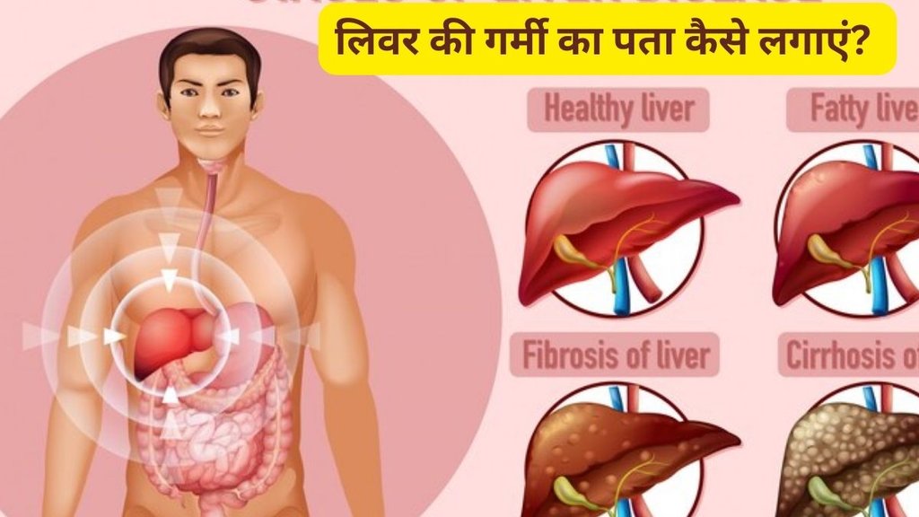 Liver Heat,Liver Heat Symptoms,Liver Heat Cause, Liver Heat cure, best home remedies for liver heat control,