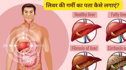 लिवर में गर्मी होने से क्या मतलब है? किन फूड्स का सेवन करने से बढ़ती है ये हीट, नित्यानंदम श्री से जानिए जिगर की आग का इलाज