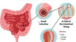 आंत में सूजन होने पर बॉडी में दिखते हैं ये 5 लक्षण, इंफ्लामेशन कंट्रोल करने के लिए करें इन Foods का सेवन, पेट दर्द और ऐंठन से भी मिलेगी राहत