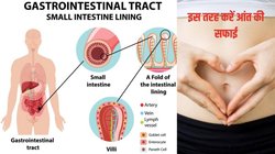 आंतों में मल सूखने पर बॉडी में दिखते हैं ये लक्षण, इन 4 आयुर्वेदिक नुस्खों का करें सेवन, गट की गंदगी हो जाएगी दूर और कब्ज से मिलेगा छुटकारा