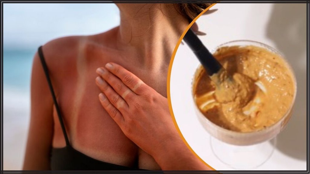 Sun Tan । tanning removal । How to get rid of tanning