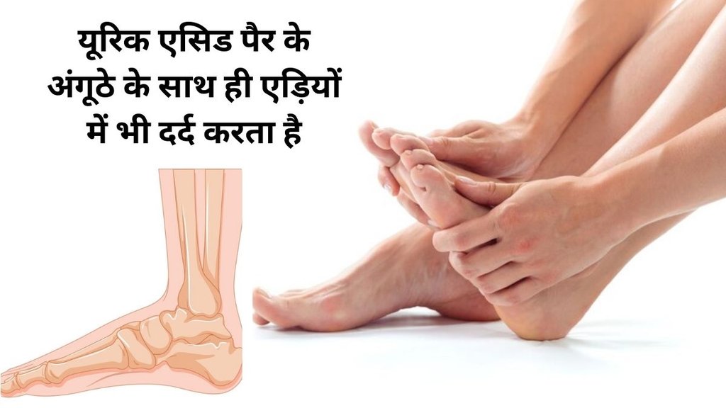 Uric Acid Treatment in Ayurveda, यूरिक एसिड की रामबाण दवा, Foods to control Uric Acid,Diet to control uric acid,यूरिक एसिड,These foods give life to weak nerves,Best fruits for Uric Acid