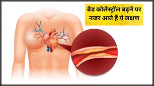 Bad Cholesterol Signs On Face । Cholesterol symptoms । Cholesterol Symptoms on face