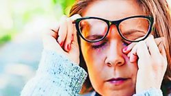 Eye flu or Conjunctivitis:आंखों के सामने जोखिम की आहट, आ रहा संक्रमण का समय, बारिश से पहले रखें खास ध्यान