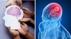 World Brain Tumor Day 2024: बेहद आम से नजर आने वाले इन लक्षणों को न करें नजरअंदाज! हो सकते हैं ब्रेन ट्यूमर के संकेत