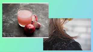 Onion juice for Dandruff