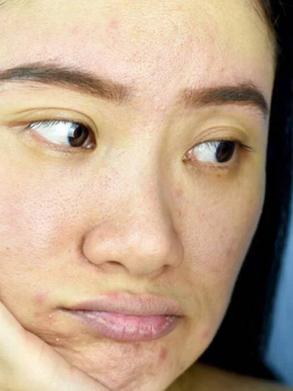 dull skin causes in hindi