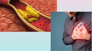 warning signs of clogged arteries