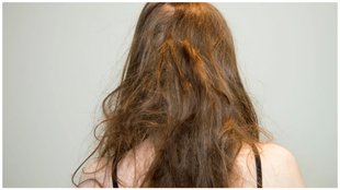 aloevera with vitamin e for hair