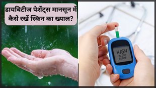 Monsoon Skincare For Diabetics । Monsoon Skincare Tips । Diabetes