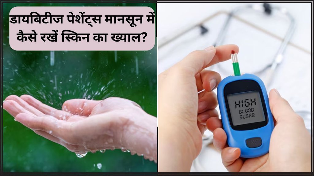 Monsoon Skincare For Diabetics । Monsoon Skincare Tips । Diabetes