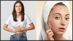 Constipation । Constipation Home Remedies । bowel movement