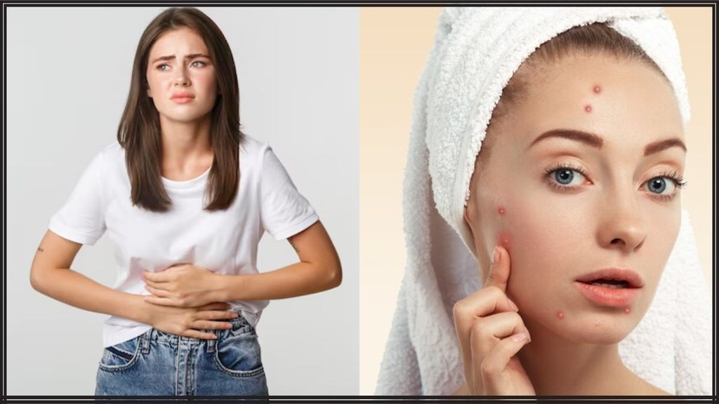 Constipation । Constipation Home Remedies । bowel movement