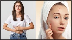 सुबह पेट साफ नहीं होता है तो पानी में मिलाकर पी लें ये 2 चीजें, सुधर जाएगी गट हेल्थ, स्किन पर भी आएगा कमाल का ग्लो