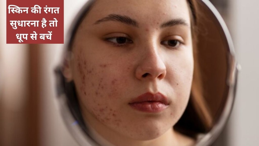 Hyperpigmentation , pigmentation , how to stop hyperpigmentation , how to remove pigmentation from face permanently , how to remove pigmentation from face permanently naturally