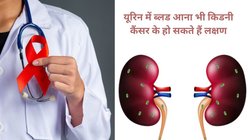 बॉडी में दिखने वाले ये 12 लक्षण कहीं Kidney Cancer के संकेत तो नहीं, अभी कर लेंगे पहचान तो बच सकती है जान
