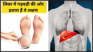 Liver problems । Liver problems sign in foot । Foot symptoms as warning signs of liver disease