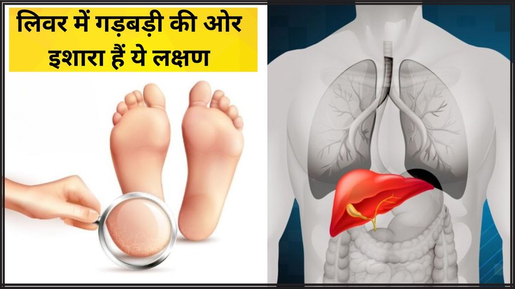 Liver problems । Liver problems sign in foot । Foot symptoms as warning signs of liver disease