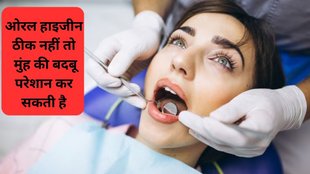 white tooth,white teeth,turmeric,teeth whitening,oral care,